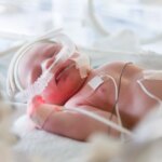 Prématurité : état de santé des enfants nés trop tôt en France dix ans après leur naissance
