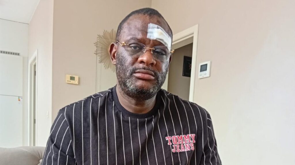 Un journaliste congolais agressé à Tirlemont pour la deuxième fois en quelques semaines.