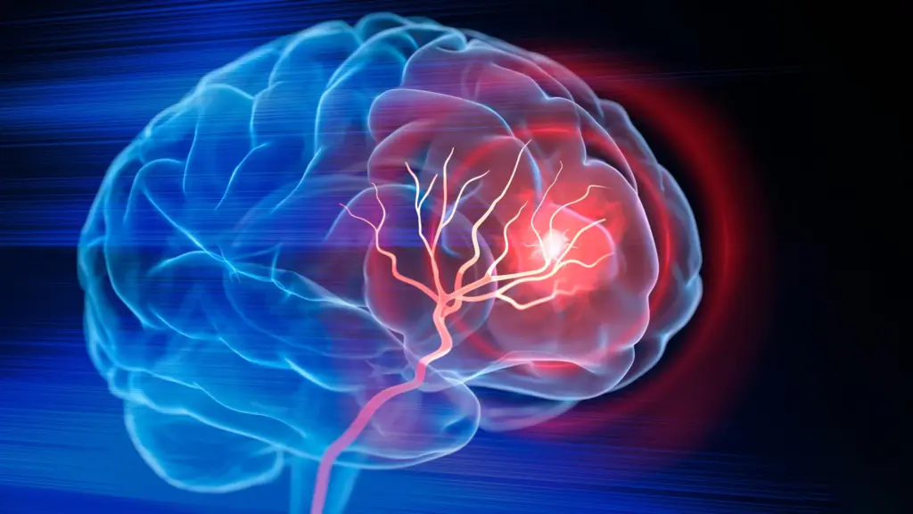 Un traitement injectable aide le cerveau à se reconstruire après un AVC, selon des chercheurs.