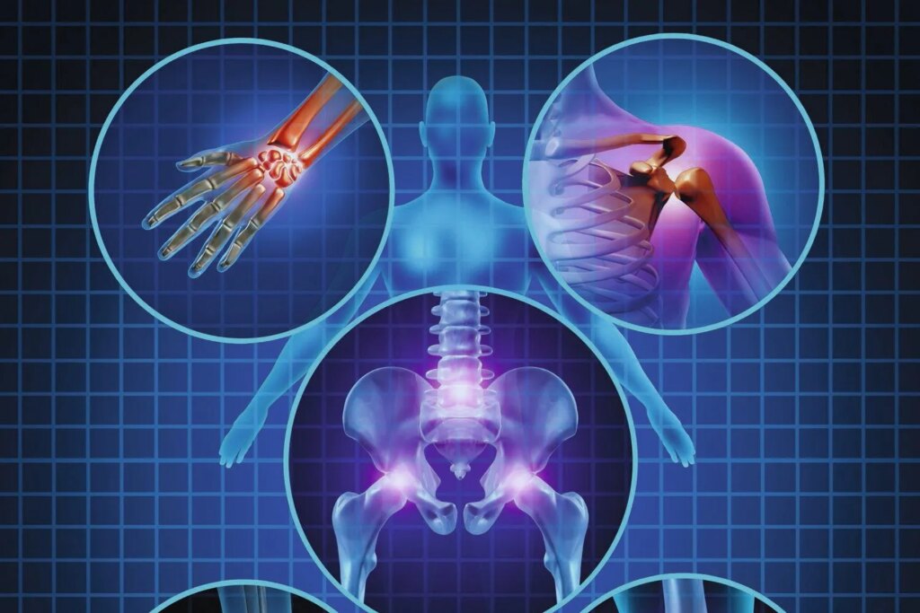 Arthrose : une inflammation liée aux modes de vie observée chez les adultes actifs