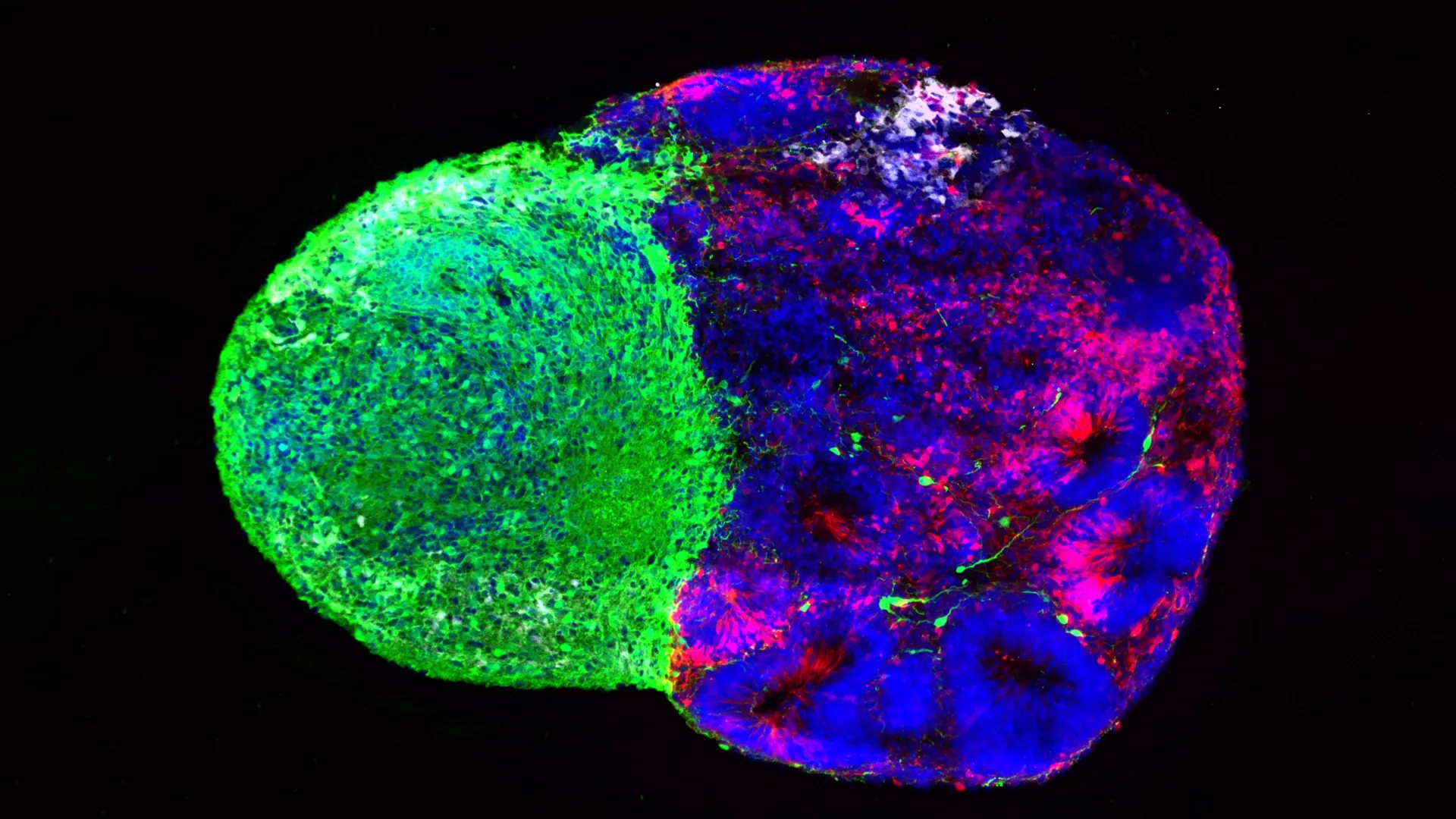 Des scientifiques identifient les instructions cachées de la construction du cerveau humain.
